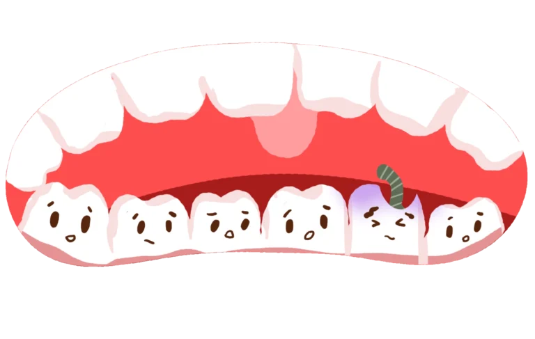 Dấu hiệu sâu răng và điều trị